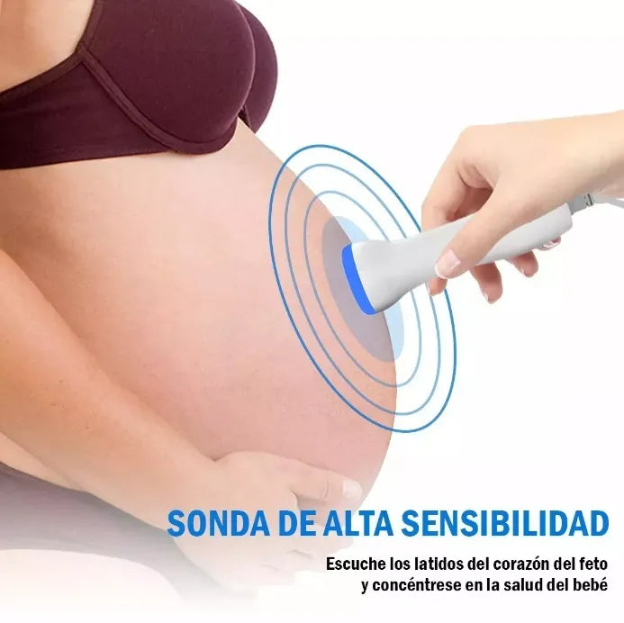 MONITOR DE FRECUENCIA CARDIACA FETAL